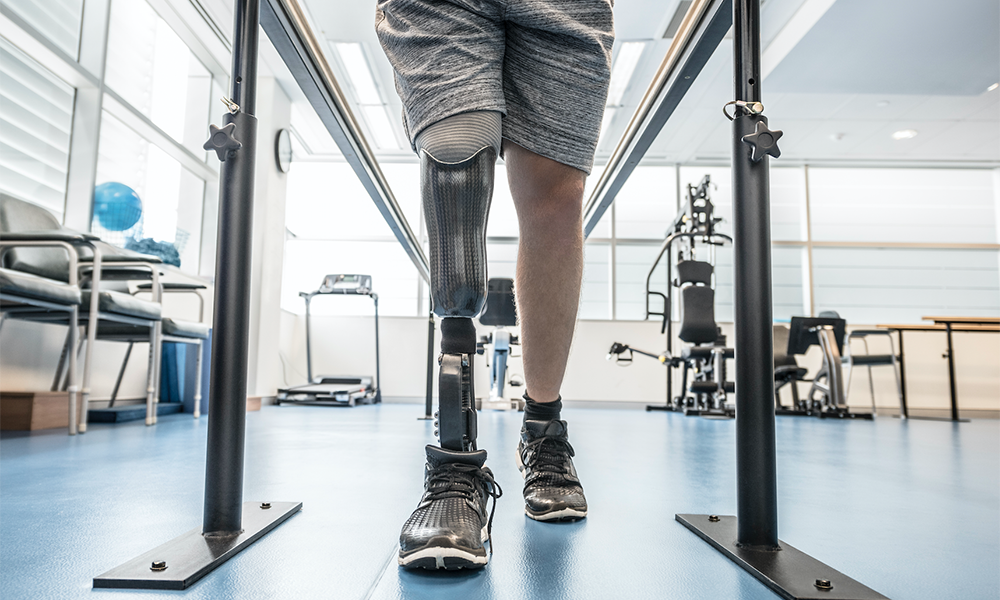 Researchers turn plastic water bottles into prosthetic limbs